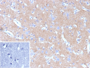 IHC staining of FFPE human brain tissue with HK1 antibody (clone HK1/9507). Inset: PBS used in place of primary Ab (secondary Ab negative control). HIER: boil tissue sections in pH 9 10mM Tris with 1mM EDTA for 20 min and allow to cool before testing.