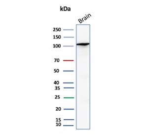 Western blot testing of human brain tissue lysate with HK1 antibody (clone HK1/9509). Predicted molecular weight ~120 kDa.