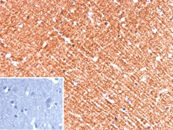 IHC staining of FFPE human brain tissue with Hexokinase 1 antibody (clone HK1/9510). Inset: PBS used in place of primary Ab (secondary Ab negative control). HIER: boil tissue sections in pH 9 10mM Tris with 1mM EDTA for 20 min and allow to cool before testing.
