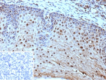IHC staining of FFPE human tonsil tissue with HLA-E antibody (clone HLAE/9468). Inset: PBS used in place of primary Ab (secondary Ab negative control). HIER: boil tissue sections in pH 9 10mM Tris with 1mM EDTA for 20 min and allow to cool before testing.