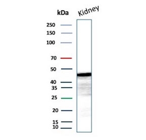 Western blot testing of human kidney tissue lysate with IDH1-R132G antibody (clone IDH1.R132G/13054R). Predicted molecular weight ~47 kDa.