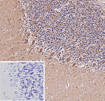 IHC staining of FFPE human brain tissue with recombinant Amyloid beta antibody (clone APP/9971R). Inset: PBS used in place of primary Ab (secondary Ab negative control). HIER: boil tissue sections in pH 9 10mM Tris with 1mM EDTA for 20 min and allow to cool before testing.