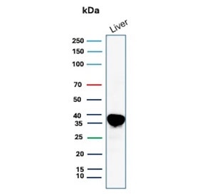 Western blot testing of human liver tissue lysate with Arginase 1 antibody (clone ARG1/9446). Predicted molecular weight ~35 kDa.