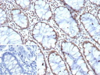 IHC staining of FFPE human colon tissue with HES5 antibody (clone HES5/8035). Inset: PBS used in place of primary Ab (secondary Ab negative control). HIER: boil tissue sections in pH 9 10mM Tris with 1mM EDTA for 20 min and allow to cool before testing.