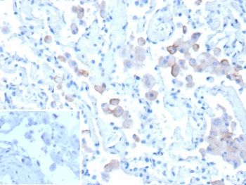 IHC staining of FFPE human lung tissue with Mannose Receptor antibody (clone MRC1/9457). Inset: PBS used in place of primary Ab (secondary Ab negative control). HIER: boil tissue sections in pH 9 10mM Tris with 1mM EDTA for 20 min and allow to cool before testing.