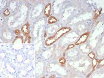 IHC staining of FFPE human kidney tissue with NDPK-B antibody (clone NME2/6436). Inset: PBS used in place of primary Ab (secondary Ab negative control). HIER: boil tissue sections in pH 9 10mM Tris with 1mM EDTA for 20 min and allow to cool before testing.
