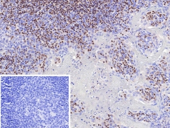 IHC staining of FFPE human tonsil tissue with Paired box 3 antibody (clone PAX3/8424). Inset: PBS used in place of primary Ab (secondary Ab negative control). HIER: boil tissue sections in pH 9 10mM Tris with 1mM EDTA for 20 min and allow to cool before testing.