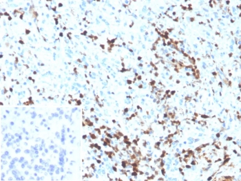 IHC staining of FFPE human spleen tissue with S100A4 antibody (clone S100A4/6801). Inset: PBS used in place of primary Ab (secondary Ab negative control). HIER: boil tissue sections in pH 9 10mM Tris with 1mM EDTA for 20 min and allow to cool before testing.