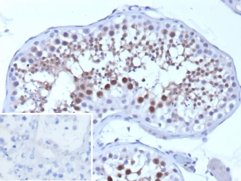 IHC staining of FFPE human testis tissue with SMN1 antibody (clone SMN1/1596). Inset: PBS used in place of primary Ab (secondary Ab negative control). HIER: boil tissue sections in pH 9 10mM Tris with 1mM EDTA for 20 min and allow to cool before testing.