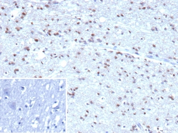 IHC staining of FFPE human brain tissue with recombinant Ubiquitin antibody (clone rUBB/9476). Inset: PBS used in place of primary Ab (secondary Ab negative control). HIER: boil tissue sections in pH 9 10mM Tris with 1mM EDTA for 20 min and allow to cool before testing.