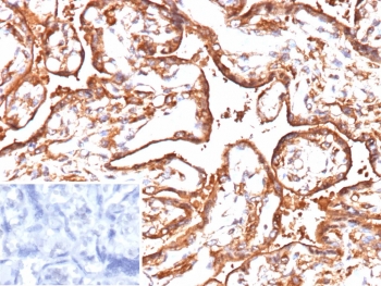 IHC staining of FFPE human placenta tissue with VEGFA antibody (clone VEGF/9368). Inset: PBS used in place of primary Ab (secondary Ab negative control). HIER: boil tissue sections in pH 9 10mM Tris with 1mM EDTA for 20 min and allow to cool before testing.