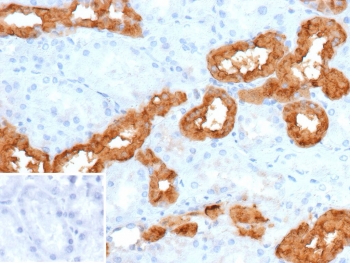 IHC staining of FFPE human tonsil tissue with CALB1 antibody (clone KR6). Inset: PBS used in place of primary Ab (secondary Ab negative control). HIER: boil tissue sections in pH 9 10mM Tris with 1mM EDTA for 20 min and allow to cool before testing.