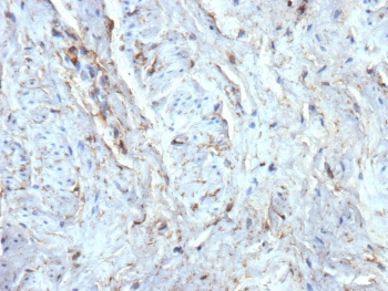 IHC staining of FFPE human uterus tissue with recombinant CD34 antibody (clone rICO-115). HIER: boil tissue sections in pH 9 10mM Tris with 1mM EDTA for 20 min and allow to cool before testing.
