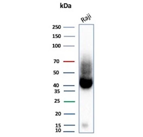 Western blot testing of human Raji tissue lysate with ADPRC1 antibody (clone CD38/9333). Expected molecular weight: 34-46 kDa depending on glycosylation level.