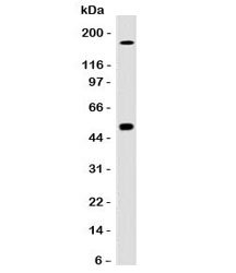 Western blot testing of HCT116 cell lysate with CAIX antibody (clone CBAD9-1). Predicted molecular weight: 50-55 kDa but may be observed at higher molecular weights due to glycosylation.