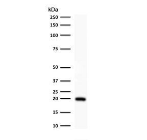 Western blot testing of human HeLa cell lysate with Ferritin antibody (clone FTLC1-1). Predicted molecular weight: ~20 kDa.