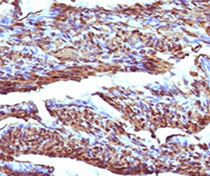 IHC testing of formalin-fixed, paraffin-embedded human uterus stained with recombinant Calponin antibody (clone RMCN1-1). HIER: steam sections in 10mM Tris with 1mM EDTA, pH 9.0, for 10-20 min.