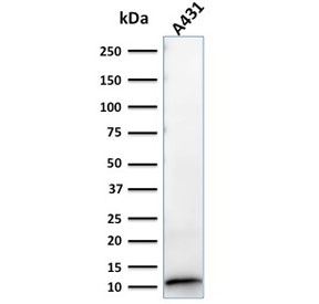 Western blot testing of human A431 lysate with S100A2 antibody (clone CPTC-S100A2-2). Expected molecular weight ~11 kDa.