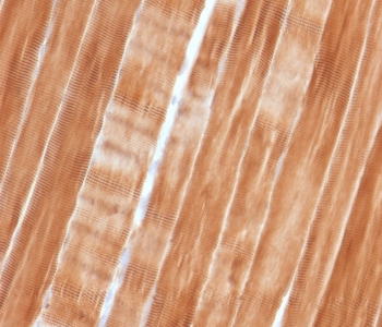 IHC staining of FFPE human skeletal muscle tissue with Sarcomeric Alpha Actinin antibody (clone SAMA-1). HIER: boil tissue sections in pH 9 10mM Tris with 1mM EDTA for 10-20 min and allow to cool before testing.