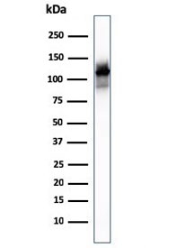Western blot testing of human skeletal muscle lysate with Sarcomeric Alpha Actinin antibody (clone ACTN2/3293). Predicted molecular weigth ~103 kDa.