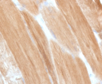 IHC staining of FFPE skeletal muscle with Dystrophin antibody (clone DSTN-1). HIER: boil tissue sections in pH 9 10mM Tris with 1mM EDTA for 10-20 min and allow to cool before testing.