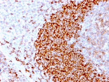 IHC staining of FFPE human tonsil tissue with recombinant CD79b antibody (clone IGB/3170R). HIER: boil tissue sections in pH 9 10mM Tris with 1mM EDTA for 10-20 min followed by cooling at RT for 20 min.