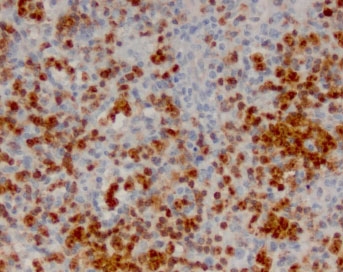 IHC staining of FFPE human lymph node with ANXA1 antibody (clone ANNX1-1). HIER: boil tissue sections in pH 9 10mM Tris with 1mM EDTA for 10-20 min and allow to cool before testing.