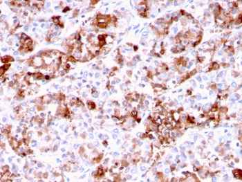 IHC testing of FFPE human pituitary tissue with Prolactin antibody (clone PRL/2644). Required HIER: boil tissue sections in pH 9 10mM Tris with 1mM EDTA for 10-20 min followed by cooling at RT for 20 min.