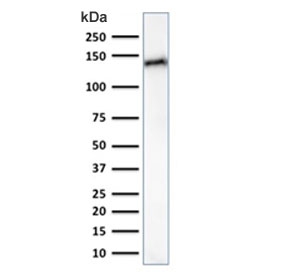 Western blot testing of human small intestine lysate with Cadherin 17 antibody (clone CDH17/2617). Predicted molecular weight ~92 kDa but may be observed at higher molecular weights due to glycosylation.