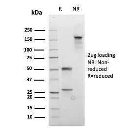 SDS-PAGE analysis of purified, BSA-free recombinant Desmocollin 2/3 antibody (clone rDSC2/3437) as confirmation of integrity and purity.