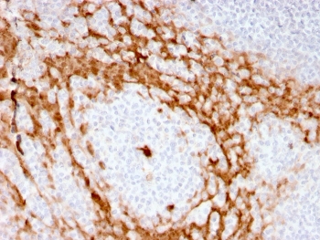 IHC staining of FFPE human tonsil with recombinant GCSF antibody (clone CSF3/3166R). HIER: boil tissue sections in pH 9 10mM Tris with 1mM EDTA for 10-20 min and allow to cool before testing.
