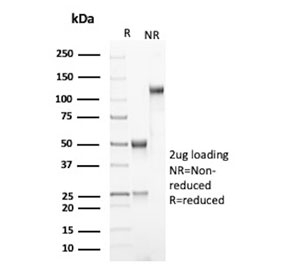 SDS-PAGE analysis of purified, BSA-free Fibrinogen Alpha Chain antibody (clone UC45) as confirmation of integrity and purity.