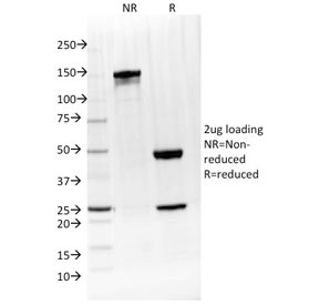 SDS-PAGE analysis of purified, BSA-free Interleukin 4 antibody (clone IL4/1597) as confirmation of integrity and purity.