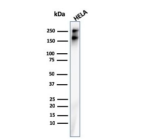 Western blot testing of human HeLa cell lysate with recombinant Spectrin beta III antibody. Predicted molecular weight ~246 kDa.