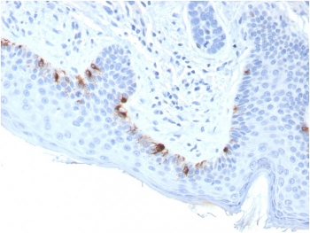 IHC staining of FFPE human skin with TRP1 antibody (clone TYRP1/3283). HIER: boil tissue sections in pH 9 10mM Tris with 1mM EDTA for 20 min and allow to cool before testing.