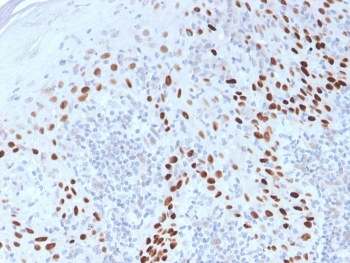 IHC staining of FFPE human cervix with p40 antibody. HIER: boil tissue sections in pH 9 10mM Tris with 1mM EDTA for 20 min and allow to cool before testing.