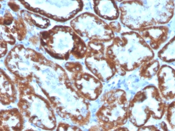 IHC staining of FFPE human kidney with CD137L antibody. HIER: boil tissue sections in pH 9 10mM Tris with 1mM EDTA for 10-20 min and allow to cool before testing.