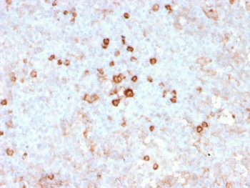 IHC staining of FFPE human spleen with recombinant CD14 antibody (clone rLPSR/2408). HIER: boil tissue sections in pH 9 10mM Tris with 1mM EDTA for 20 min and allow to cool before testing.