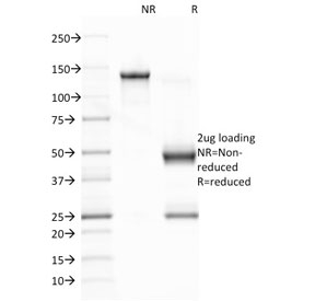 SDS-PAGE analysis of purified, BSA-free Epstein-Barr Virus antibody (clone CS1) as confirmation of integrity and purity.