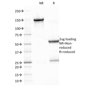 SDS-PAGE analysis of purified, BSA-free Epstein-Barr Virus antibody (clone CS2) as confirmation of integrity and purity.
