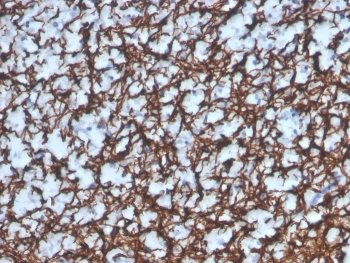 IHC staining of FFPE human brain with recombinant Myelin Basic Protein antibody (clone MBP/4277R). HIER: boil tissue sections in pH 9 10mM Tris with 1mM EDTA for 20 min and allow to cool before testing.