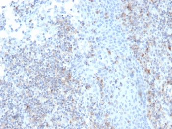 IHC staining of FFPE human tonsil with recombinant CD50 antibody (clone rICAM3/1019). HIER: boil tissue sections in pH 9 10mM Tris with 1mM EDTA for 20 min and allow to cool before testing.
