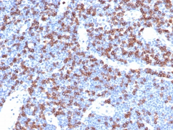 IHC staining of FFPE human lymph node tissue with recombinant CD8A antibody (clone CD8/4391R). HIER: boil tissue sections in pH 9 10mM Tris with 1mM EDTA for 20 min and allow to cool before testing.