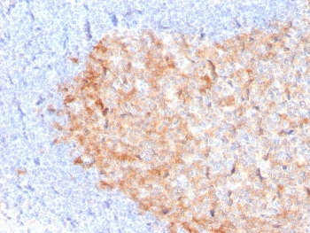 IHC staining of FFPE human tonsil with CD86 antibody (clone C86/3713). HIER: boil tissue sections in pH 9 10mM Tris with 1mM EDTA for 20 min and allow to cool before testing.