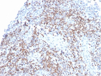 IHC staining of FFPE human tonsil with recombinant ZAP70 antibody. HIER: boil tissue sections in pH 9 10mM Tris with 1mM EDTA for 20 min and allow to cool before testing.