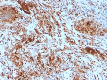 IHC staining of FFPE human tonsil with TIM3 antibody. HIER: boil tissue sections in pH 9 10mM Tris with 1mM EDTA for 20 min and allow to cool before testing.