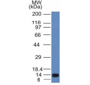 Western blot analysis of a recombinant protein fragment of ALK using Anaplastic Lymphoma Kinase antibody (clone ALK/1031).