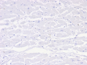 IHC staining of FFPE human heart tissue with Negative control antibody (clone IGG1/453). HIER: boil tissue sections in pH 9 10mM Tris with 1mM EDTA for 20 min and allow to cool before testing.