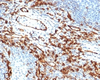 IHC staining of FFPE human tonsil tissue with CD31 antibody (clone rPECAM1/6439). HIER: boil tissue sections in pH 9 10mM Tris with 1mM EDTA for 20 min and allow to cool before testing.