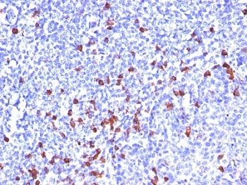 IHC: Formalin-fixed, paraffin-embedded human tonsil stained with IgG antibody (SPM556)